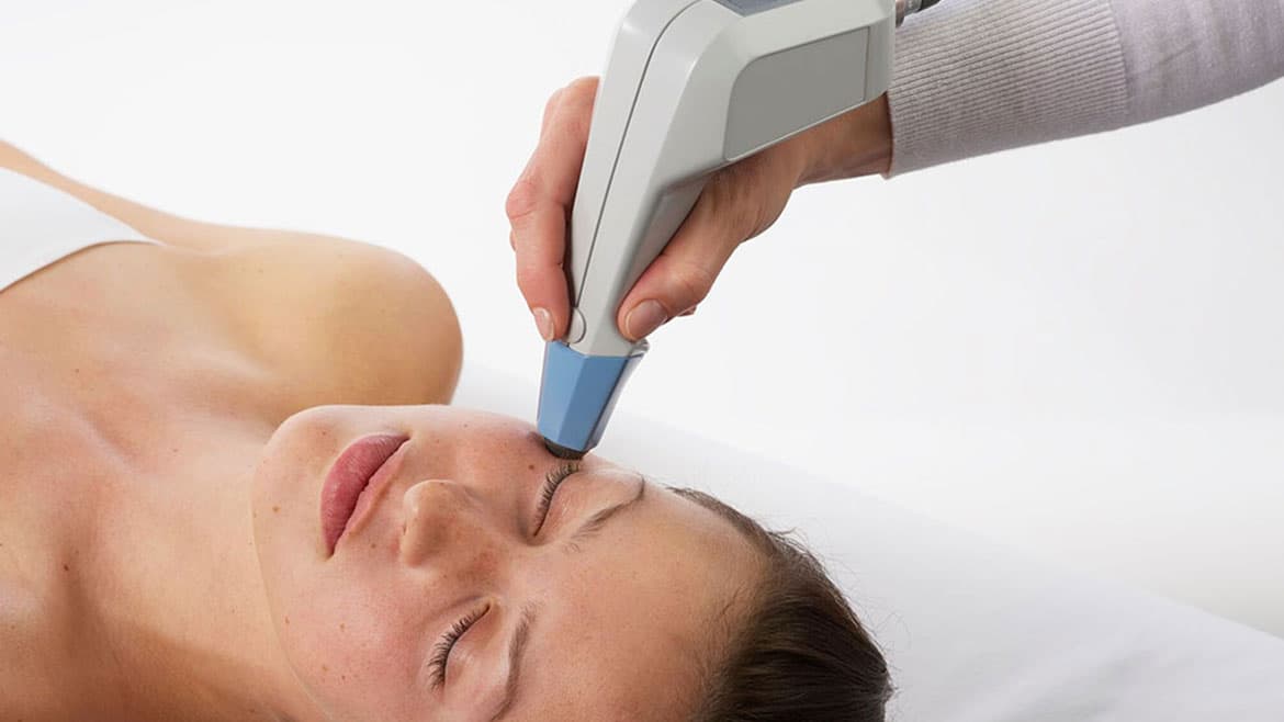 Under Eye Dark Circles