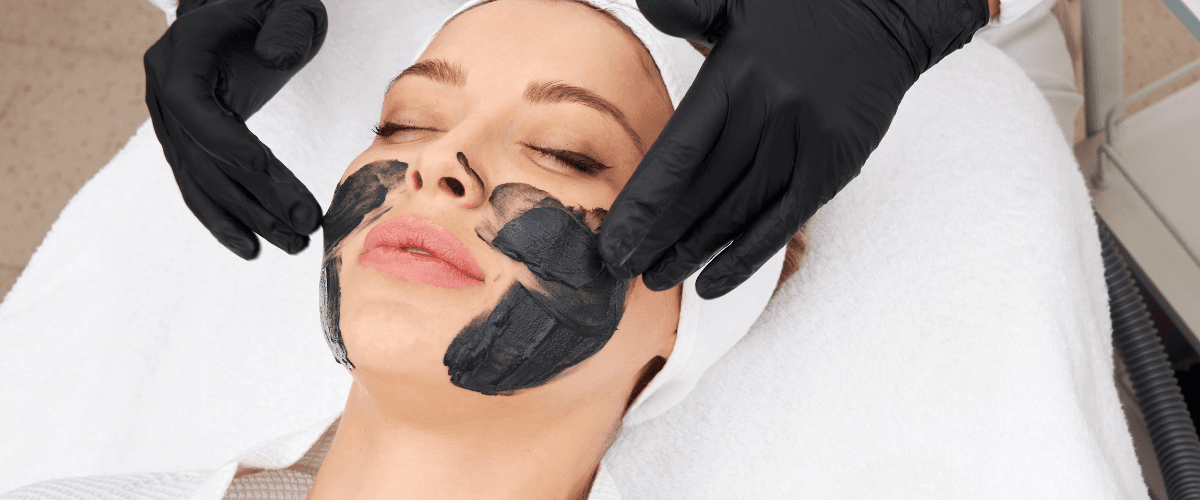 Carbon Facial for Pigmentation