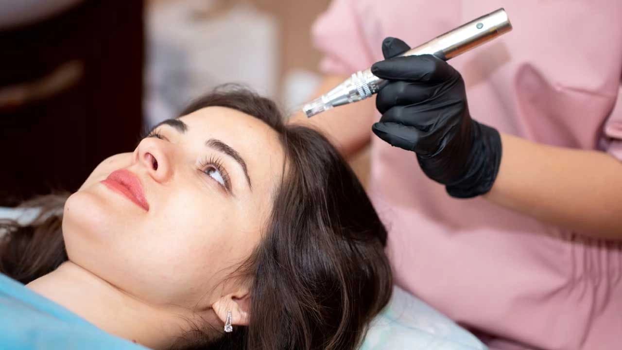 Dermapen 4 for Hair Regrowth