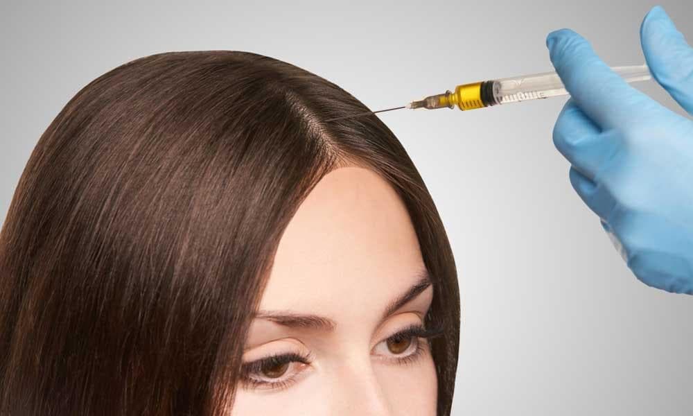 IV Therapy for Hairfall