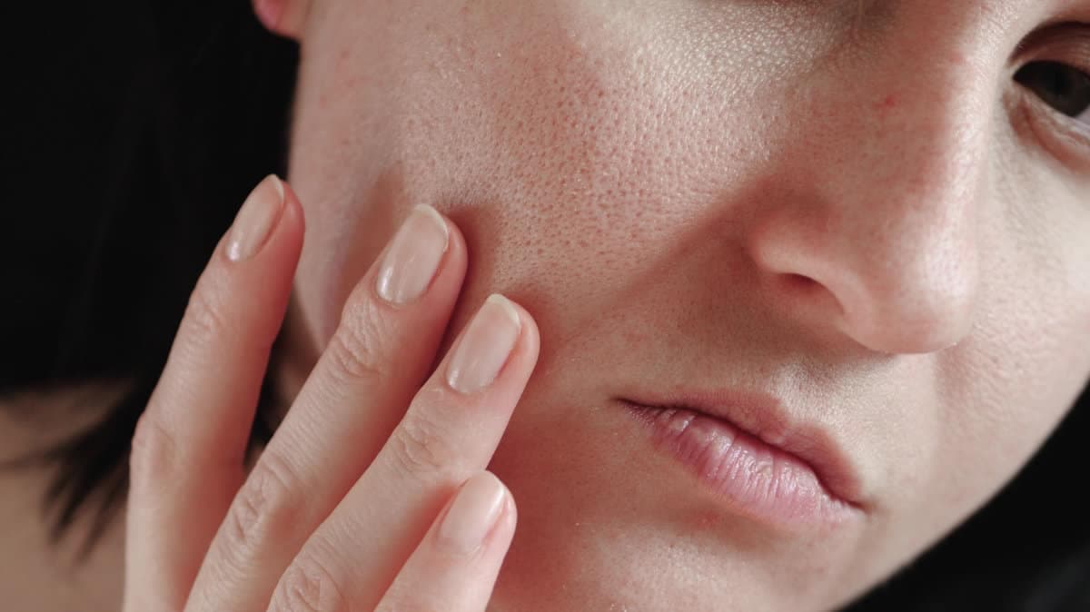 Micro-infusion facial for Open Pores