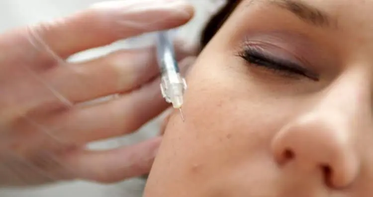 Skin Boosters for Acne Scars