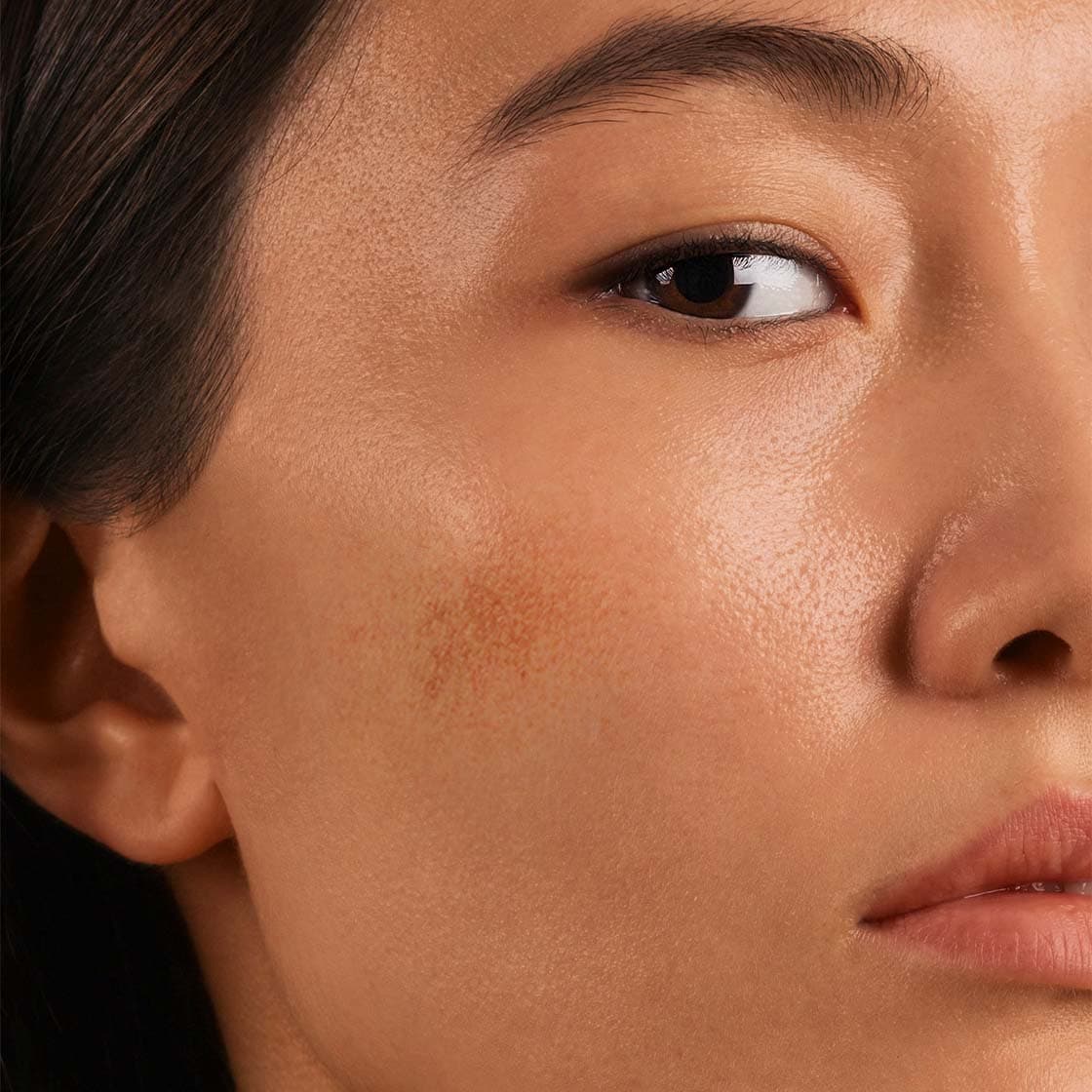 Uneven Skin Tone Treatment